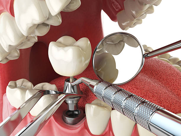 Best Cracked Tooth Emergency Dentist  in West Haven Sylvan, OR